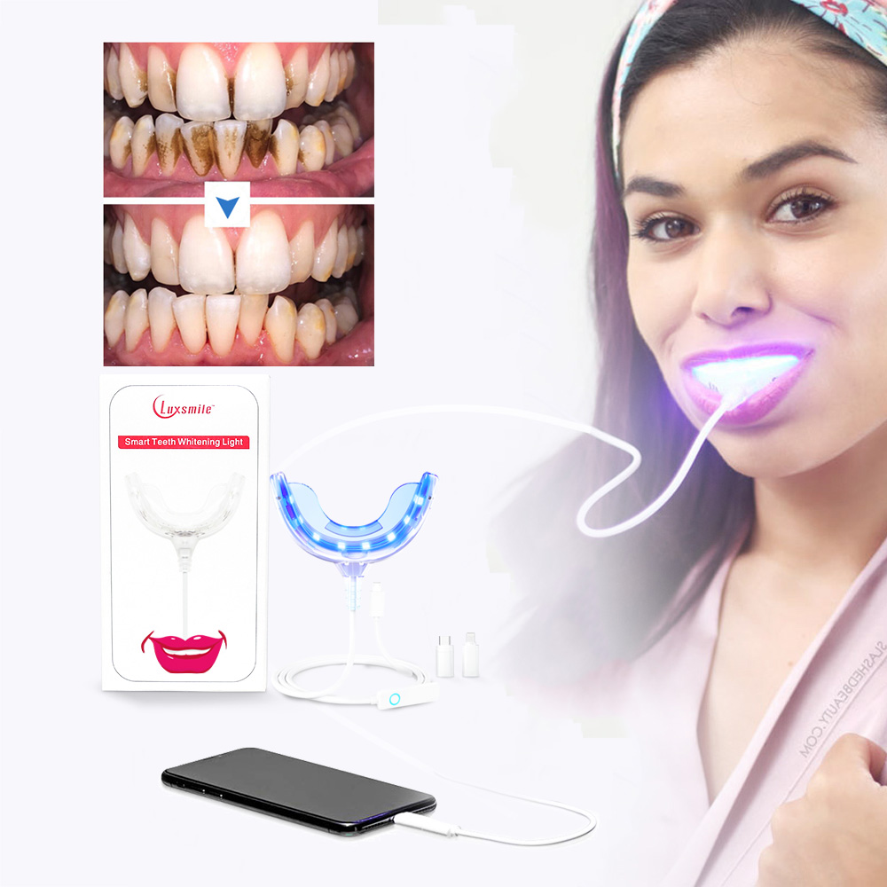 Luxsmile 스마트 LED 치아 미백 휴대용 USB - Teeth Whitening Pens 리뷰 및 가격