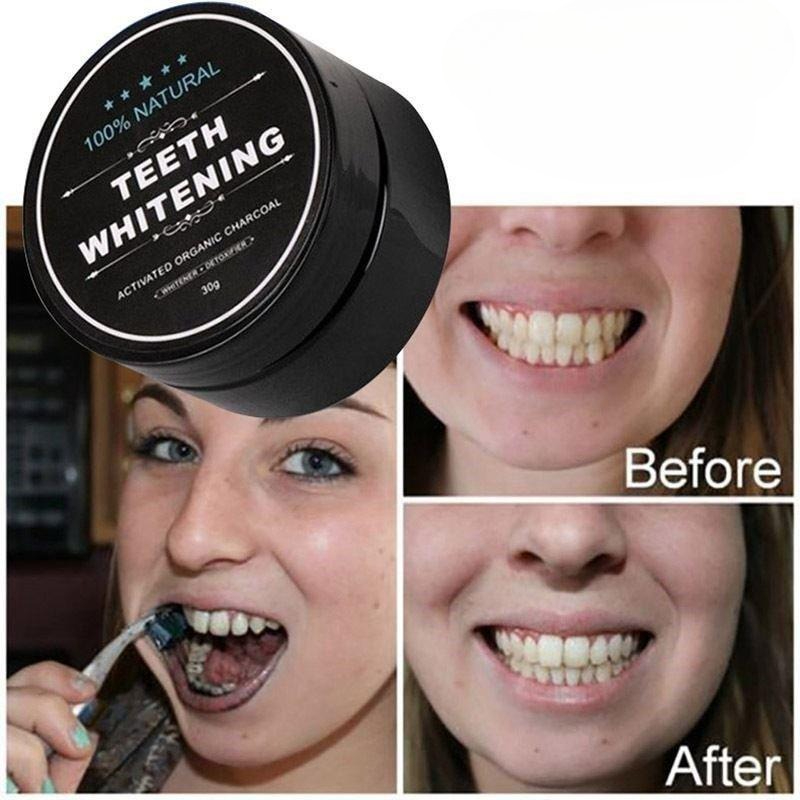 활성탄 치아 미백 파우더 1박스, 숯 치아 클리닝 파우 - Teeth Whitening Pens 리뷰 및 가격