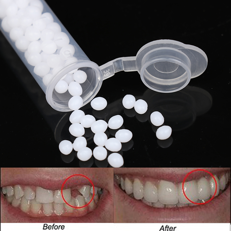 【K】1세트 임시 치아 보수 키트, 치아 및 치아 간격 - Teeth Whitening Kit 리뷰 및 가격