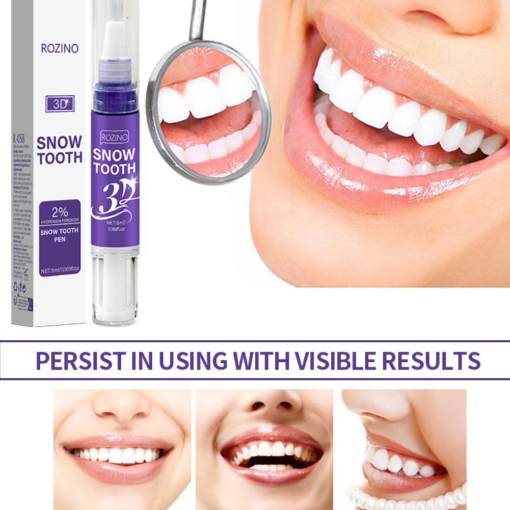 남녀 공용 구강 관리 펜, 치아 변색 방지 및 누렇게  - Teeth Whitening Pens 리뷰 및 가격