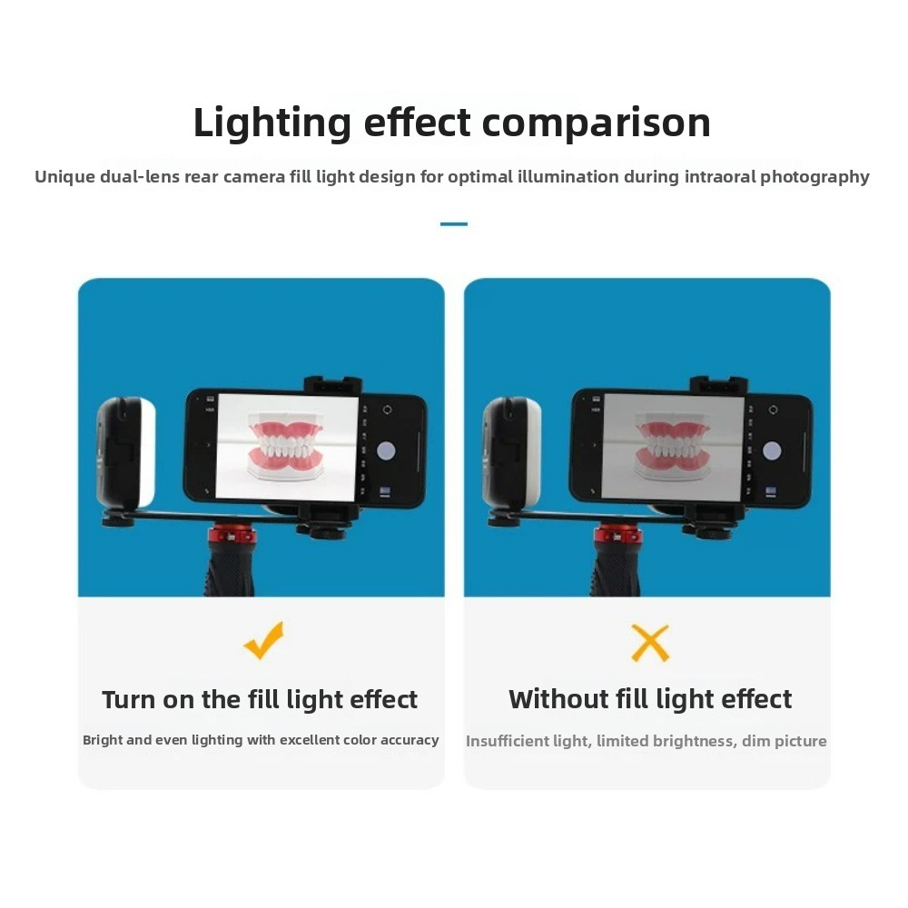 치과 사진 촬영 조명, 스마트폰용 블루투스 LED 플래 - Teeth Whitening Kit 리뷰 및 가격