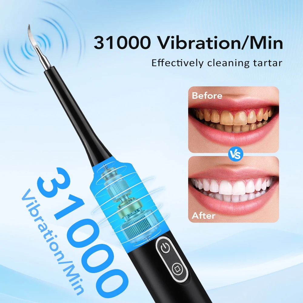 전동 음파 진동 치석 제거기 치아 미백 플라그 제거 치 - Teeth Whitening Mouthwash 리뷰 및 가격