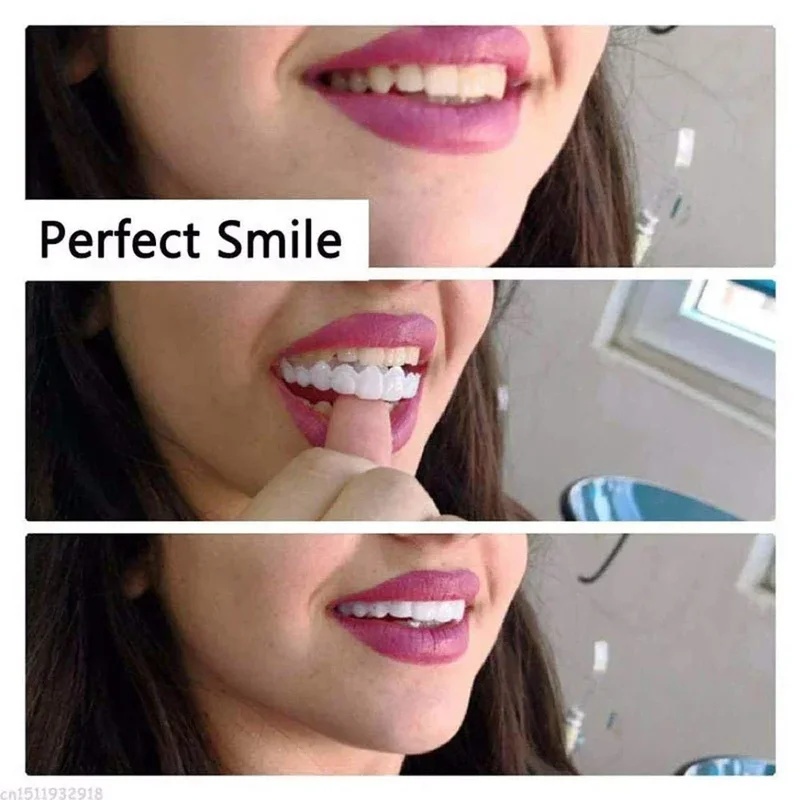 착용형 치아 보철 키트, 조절 가능한 미용용 치아 보철 - Teeth Whitening Kit 리뷰 및 가격